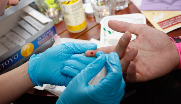 V Jihočeském kraji je 132 HIV pozitivních osob. Za rok přibylo osm nových případů