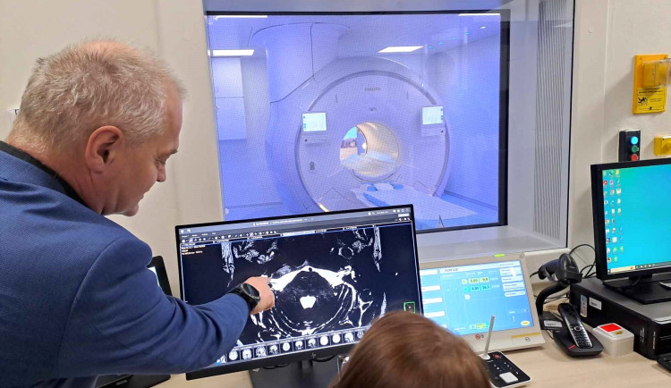 Nemocnice má novou magnetickou rezonanci s umělou inteligencí
