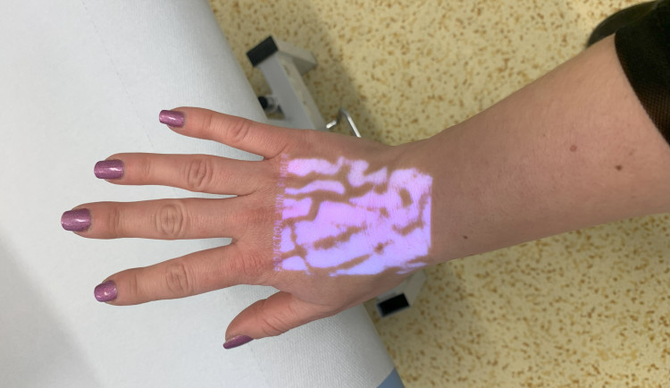 Speciální přístroj pomáhá snížit u malých pacientů strach z odběrů krve