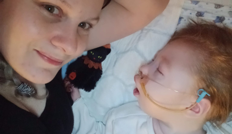 Syn má poškozený mozek a nedožije se rána, řekli Tereze po porodu. Míša teď oslaví tři roky a mamince dává velkou sílu.