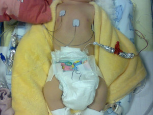 Honzík zázrakem jako miminko vyhrál nad smrtí, utrpěl ale těžké poškození mozku. Rodině chce pomoci benefice