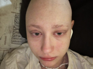 Dva roky boje s leukémií. Život Terezy zachránila i stovka přípravků od dárců krve