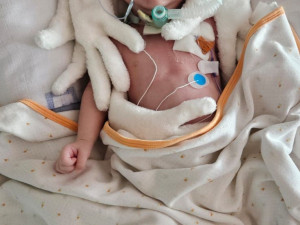 Vdechl plodovou vodu a prodělal tracheostomii. Půlroční Jiříček teď potřebuje speciální péči ve vzdálené nemocnici