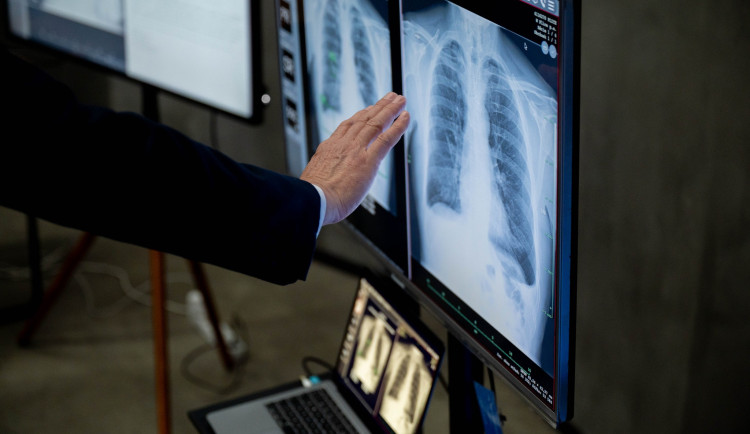 Nemocnicím na severu Moravy s léčbou a diagnostikou pomáhá nejen virtuální realita, ale i umělá inteligence