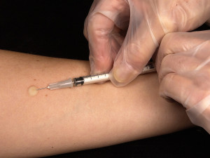 Epidemie žloutenky trvá na severu Moravy už rok. Hygienici hlásí 289 nakažených