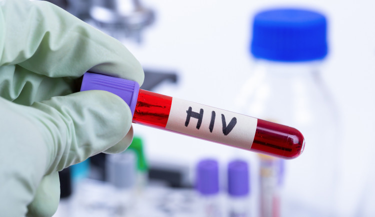 Olomoucké centrum HIV má za letošek už 11 pacientů s AIDS. Existuje prevence, nabádají lékaři