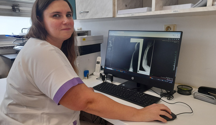 Lékaři varují před úrazy dětí na trampolínách, počty zraněných stoupají