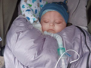 Maličký Jiřík trpí vzácnou a neléčitelnou genetickou poruchou. Má ji jen několik desítek lidí na světě