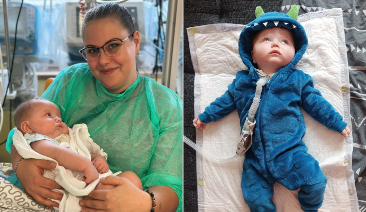 Maličký Jiřík trpí vzácnou genetickou poruchou. Má ji jen několik desítek lidí na světě