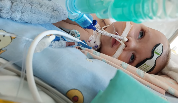 Téměř rok na přístrojích. Lékaři z Motola zachránili miminko s vzácnou srdeční vadou