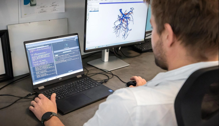 V Ostravě jako jedni z prvních využívají AI k předoperační 3D vizualizaci cév