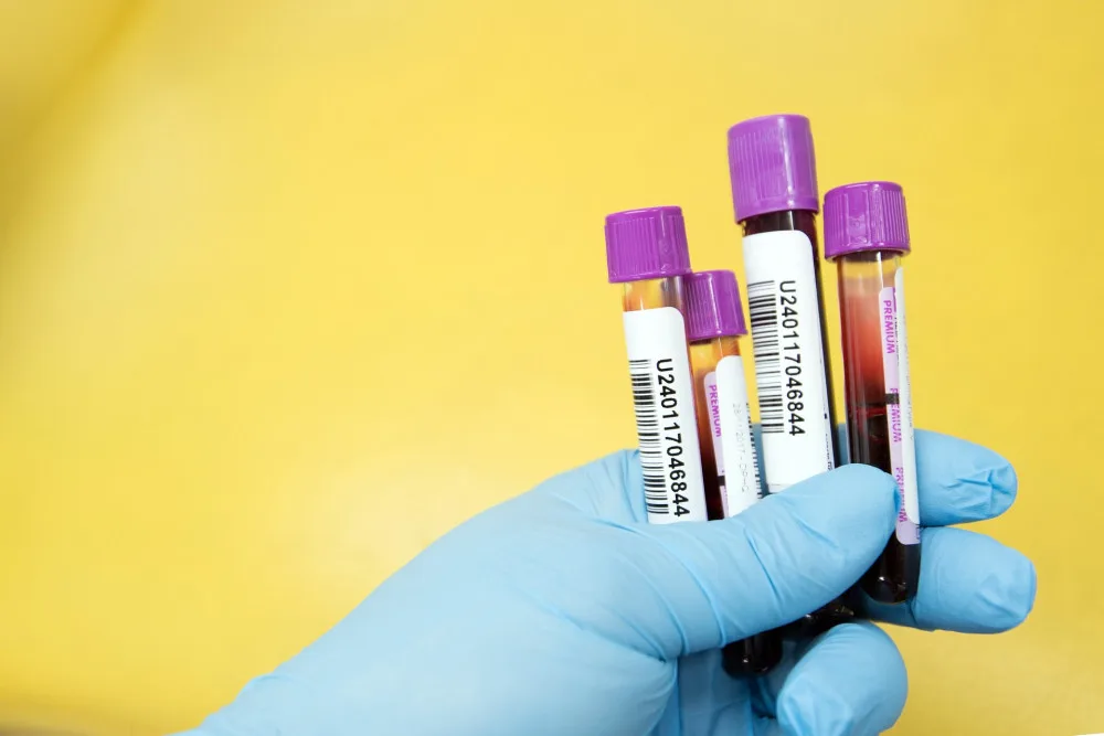 Za trošku krve klidné spaní. Jednoduchý test z krve může odhalit riziko rakoviny prostaty nebo od obav ulevit
