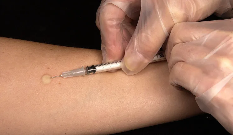 Žloutenka na vzestupu. Nemocí se loni v Moravskoslezském kraji nakazilo nejvíce lidí za 20 let