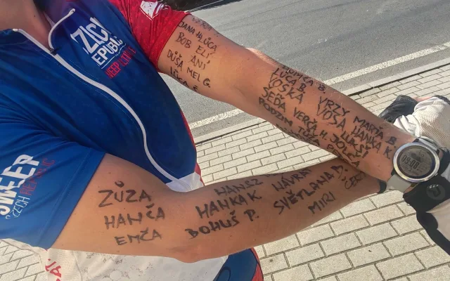 Popsané ruce Ondřeje Sejbala