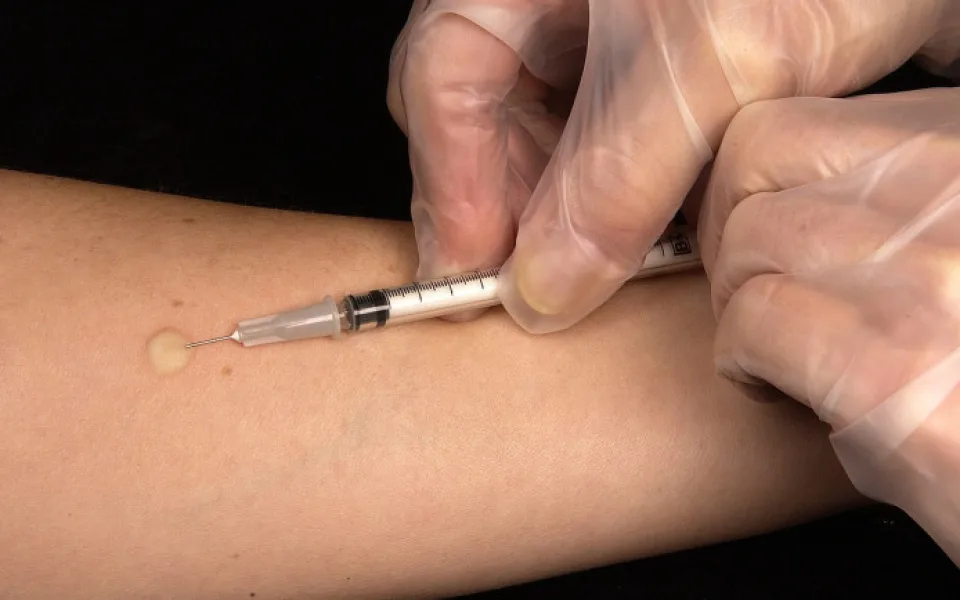 Žloutenka na vzestupu. Nemocí se loni v Moravskoslezském kraji nakazilo nejvíce lidí za 20 let