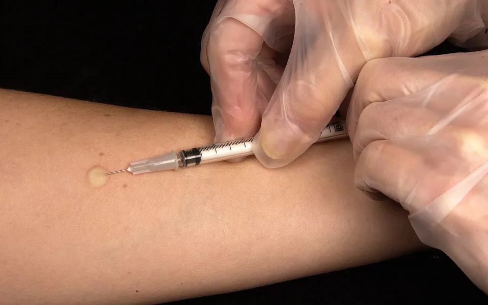 Počet nových případů žloutenky v Moravskoslezském kraji klesl o třetinu