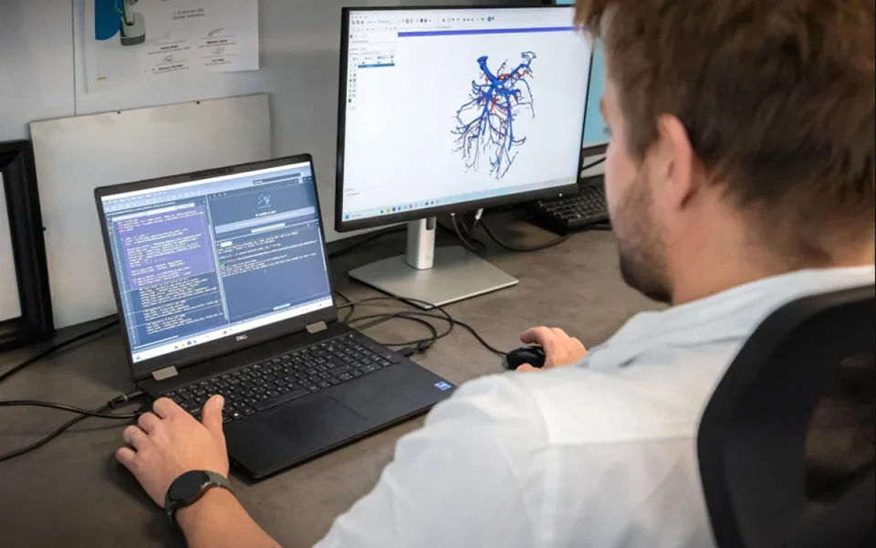 V Ostravě jako jedni z prvních využívají AI k předoperační 3D vizualizaci cév
